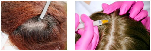 Banner restauracion cabello