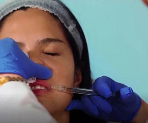 Banner de marcas de rellenos de labios