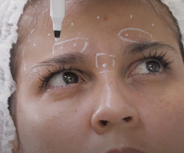 Banner de capacitacion gratuita de Botox