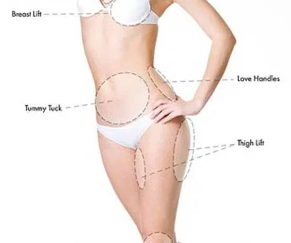 Banner de partes del cuerpo para el tratamiento de levantamiento de hilo pdo