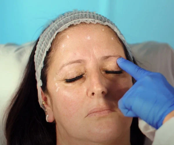 Banner guía para aplicar el tratamiento de botox