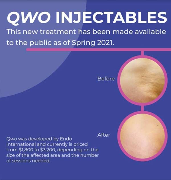 Inyectbales antes y despues