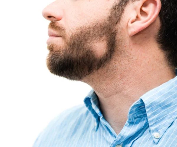 Banner de tratamientos faciales aplicados con PRP