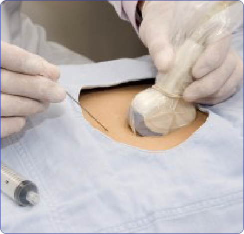 Terapia revision estomago