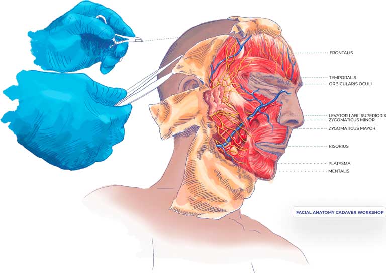 Ilustracion de la cara de un cadaver abierta