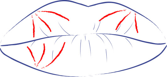 Ilustración de la técnica de abanico avanzada