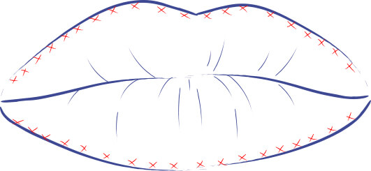 Ilustración de la técnica de labios rusos