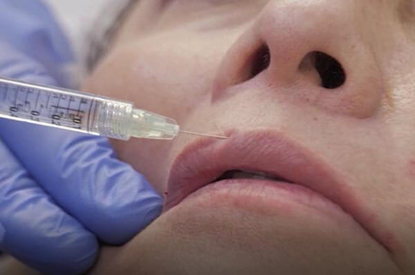Mujer siendo inyectada durante el curso