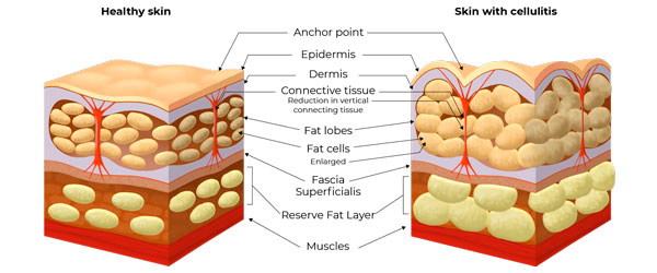 Banner del curso de inyector maestro