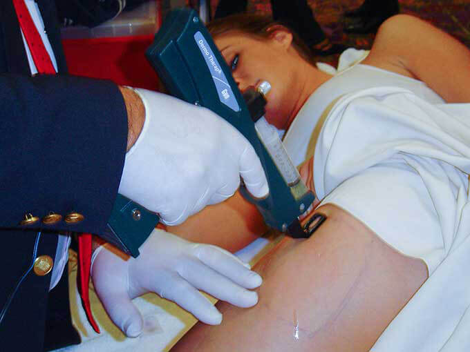 Imagen de doctor implementando meso guns