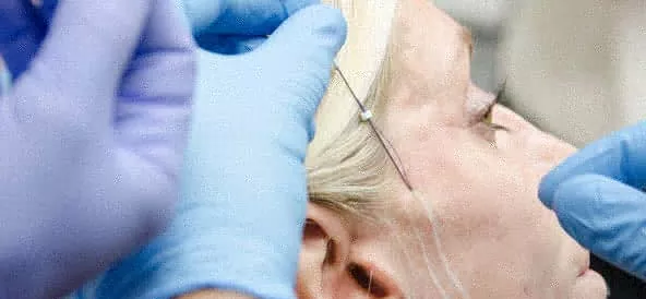 Banner de levantamiento hilos