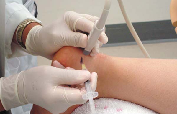 Revision ultrasonido pie