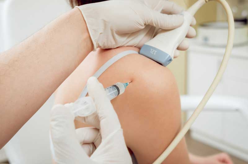 Foto de Inyeccion en una rodilla