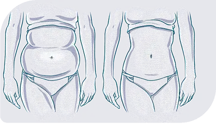 Banner del curso de liposuccion